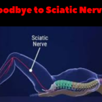 Say Goodbye to Sciatic Nerve Pain