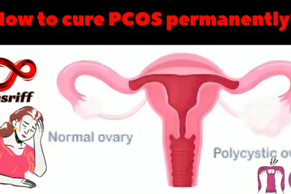 How to cure PCOS permanently?